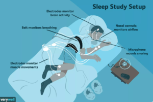 Sleep Apnea Diagnosis: The Steps - Sleep Apnea Truth